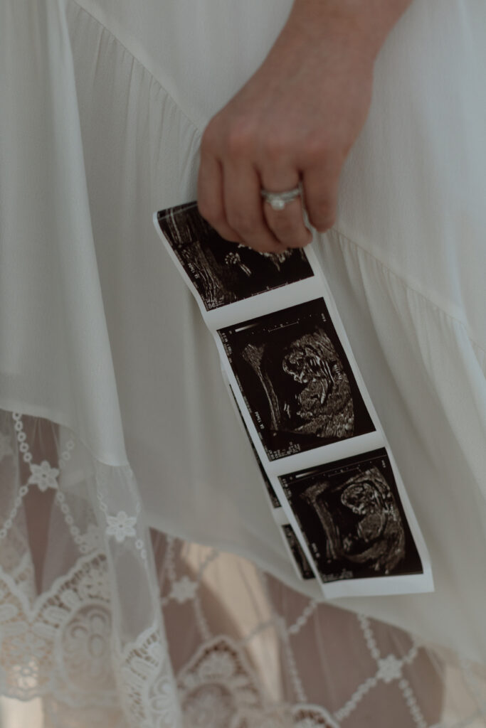 Image of the ultrasound photographed by The Deans Photography.